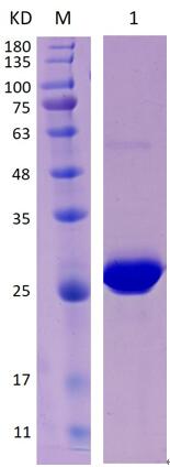 12% SDS-PAGE analysis profiles of purified NTHI1083-24-197 (CBB stained).
